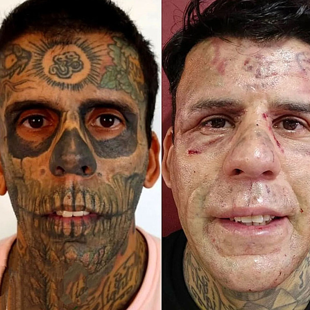 Tetování měl téměř na celém těle. Dnes se ho Brazilec pracně zbavuje