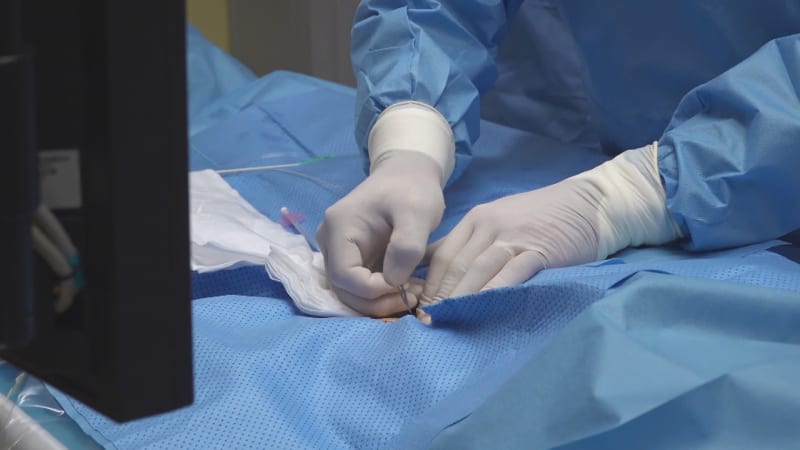 Mladík měl v konečníku zaražený dělostřelecký granát. Lékaři z Toulouse volali pyrotechniky