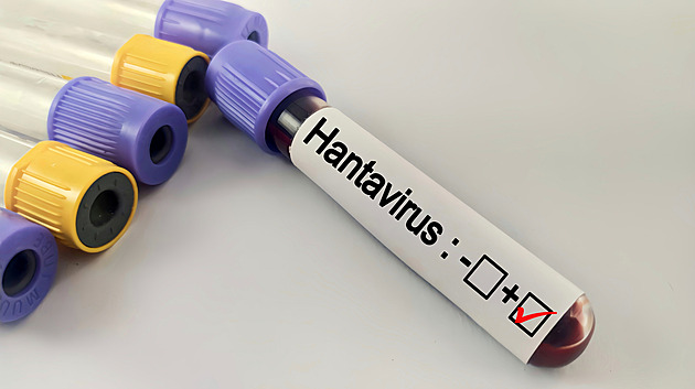 Hantavirus na vlastní kůži: tělo ochromí únava a bolest, následky cítím i po letech